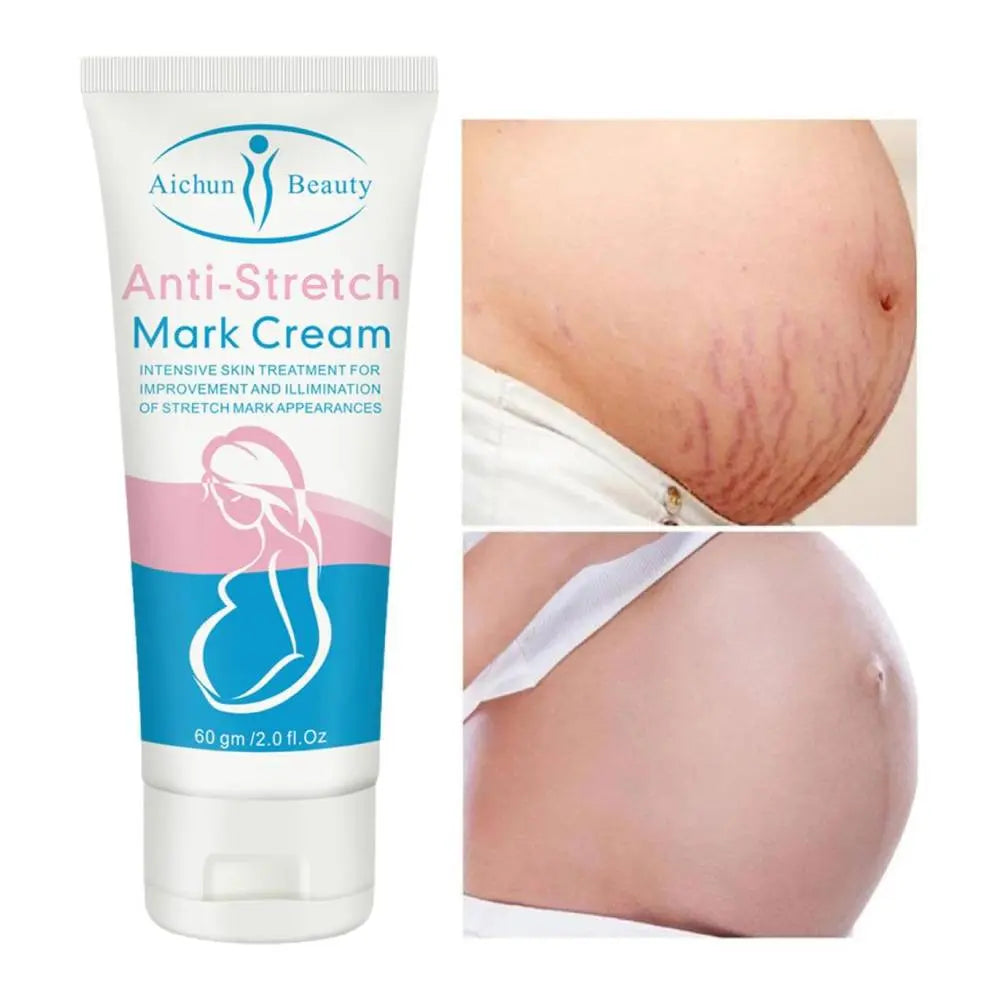 Crème Anti-Vergetures Post-Partum à la Bave d’Escargot MOMSEREINE